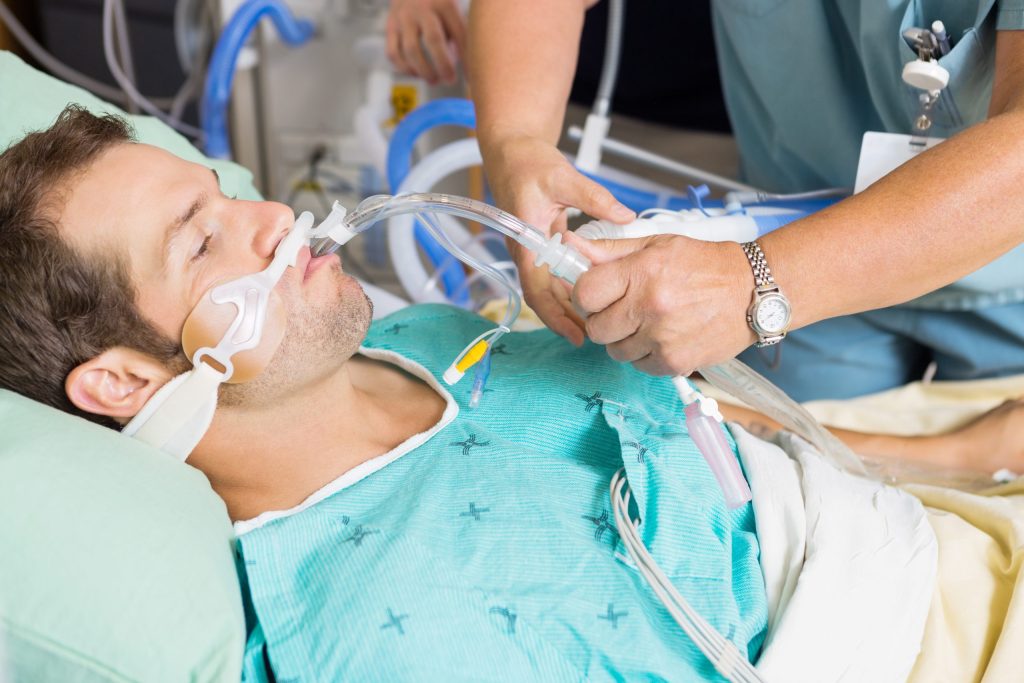 Intubation